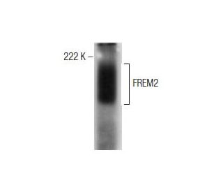 FREM2 Antibody (F-1) - Western Blotting - Image 155936 