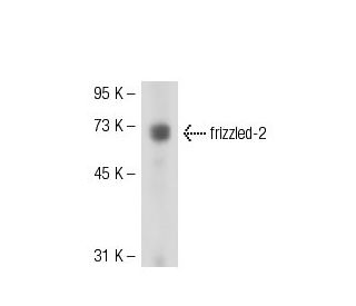 Anti Frizzled 2 Antibody K19r Scbt Santa Cruz Biotechnology