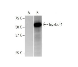 Anti Frizzled 4 Antibody 3g7 Scbt Santa Cruz Biotechnology