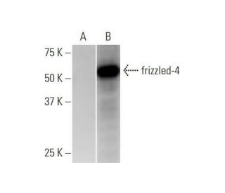 western blotting image from recommended frizzled-4 (3G7) monoclonal antibody replacement. Image 352165