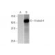 western blotting image from recommended frizzled-4 (3G7) monoclonal antibody replacement. Image 352165