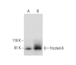 frizzled-6 Antibody (C-12) - Western Blotting - Image 299295 