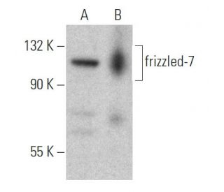 frizzled-7 Antibody (4D9) - Western Blotting - Image 367984 