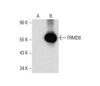 FRMD8 Antibody (E-11) - Western Blotting - Image 317977