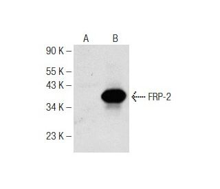 western blotting image from recommended FRP-2 (C-4) monoclonal antibody replacement. Image 142521