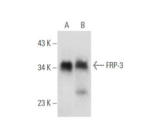 FRP-3 Antibody (B-5) - Western Blotting - Image 319594The Double Nickase Plasmid features a U6 promoter for sgRNA expression, a 20 nt targeting sequence, and a gRNA scaffold to guide Cas9n. It includes a CBh promoter for Cas9n (D10A) and puromycin resistance, GFP for transfection verification, and nuclear localization signals (NLS). The 2A peptide allows co-expression of Cas9n and Puro from a single promoter, enabling precise genome editing with reduced off-target effects.