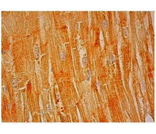 FSD2 Antibody (H-11) - Immunohistochemistry - Image 304844 