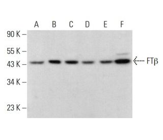 western blotting image from recommended FTβ (B-7) monoclonal antibody replacement. Image 383207