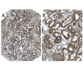 FTCD Antibody (58K-9) | SCBT - Santa Cruz Biotechnology