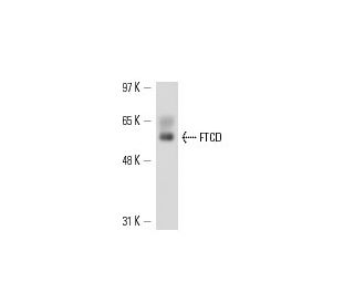 FTCD Antibody (58K-9) - Western Blotting - Image 13517 