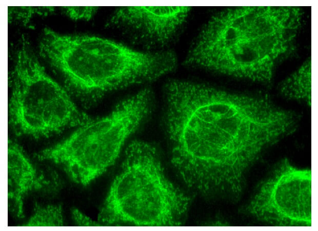 パタゴニア ＦＣD WILDBOAR5'8\"usd cps05-package.jpg