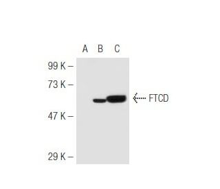 FTCD Antibody (58K-9) - Western Blotting - Image 46336 