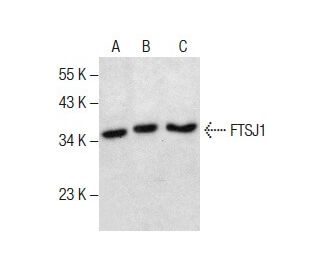 FTSJ1抗体 (B-2) | SCBT - Santa Cruz Biotechnology