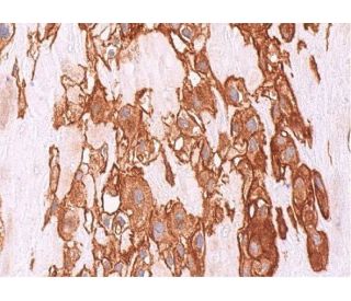 Furin Antibody (B-6) | SCBT - Santa Cruz Biotechnology