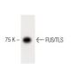 FUS/TLS Antibody (15) - Western Blotting - Image 60388