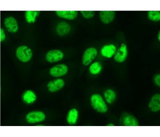 FUS/TLS Antibody (4H11) | SCBT - Santa Cruz Biotechnology