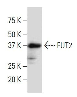 FUT2抗体 (9T-8) | SCBT - Santa Cruz Biotechnology