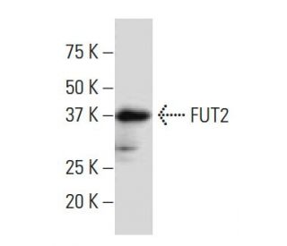FUT2 Antibody (9T-8) - Western Blotting - Image 34116Each CRISPR/Cas9 Knockout (KO) Plasmid product consists of a pool of 3 plasmids designed to ensure identification and cleavage of a specific gene for maximum knockout efficiency. Each plasmid encodes a unique 20 nt sequence derived from the GeCKO (v2) library.
