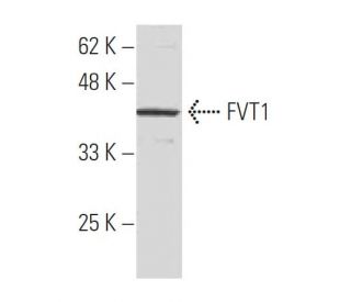 FVT1 Antibody (SS-7) - Western Blotting - Image 33962