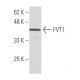 FVT1 Antibody (SS-7) - Western Blotting - Image 33962