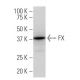 FX Antibody (43.1) - Western Blotting - Image 33905