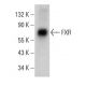 FXR/NR1H4 Antibody (D-3) - Western Blotting - Image 382261