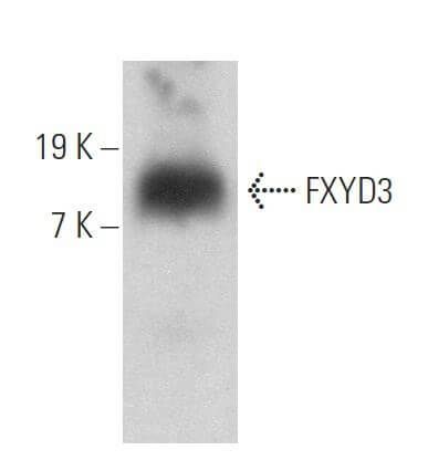 FXYD3 Antibody (A-3) | SCBT - Santa Cruz Biotechnology