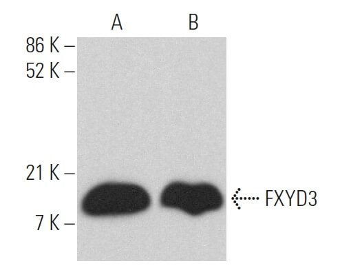Too様確認用 FXYD3 Antibody (A-8) | SCBT - Santa Cruz Biotechnology