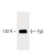 Fyb Antibody (5) - Western Blotting - Image 60389