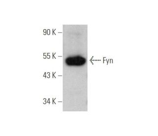 western blotting image from recommended Fyn (15) monoclonal antibody replacement. Image 352720