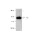 western blotting image from recommended Fyn (15) monoclonal antibody replacement. Image 352720