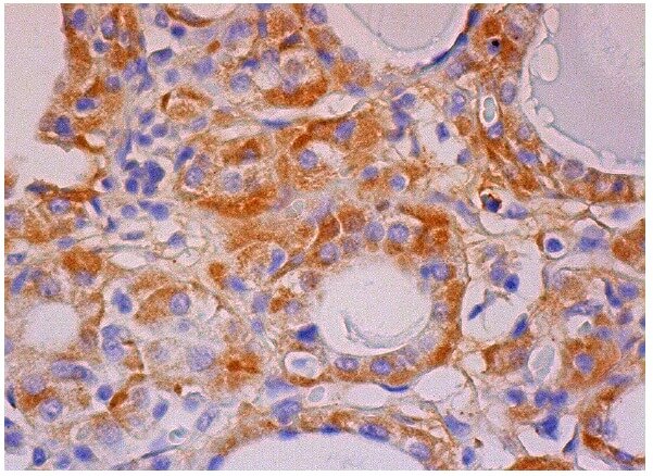 fzr Antibody (DCS-266) | SCBT - Santa Cruz Biotechnology