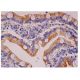 This polyclonal antibody has been discontinued. See our recommended <a href="g-csf-antibody-3d1">G-CSF (3D1)</a> monoclonal antibody (sample data shown). immunohistochemistry image from recommended G-CSF (3D1) monoclonal antibody replacement. Image 284750