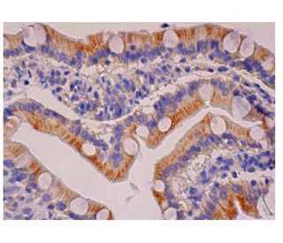immunohistochemistry image from recommended G-CSF (3D1) monoclonal antibody replacement. Image 284750