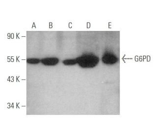 G6PD Antibody (G-6) - Western Blotting - Image 349945 