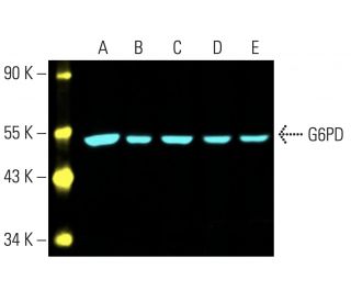 western blotting image from recommended G6PD (G-12) monoclonal antibody replacement. Image 402012