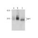 G6PT Antibody (7B9) - Western Blotting - Image 384463 