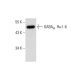 western blotting image from recommended GABAA Rα1-6 (E-8) monoclonal antibody replacement. Image 299283