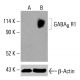 GABAB R1 Antibody (C-11) - Western Blotting - Image 415549