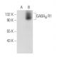 GABAB R1 Antibody (D-2) - Western Blotting - Image 73057