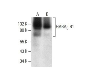 western blotting image from recommended GABAB R1 (D-2) monoclonal antibody replacement. Image 309535