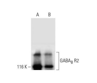 GABA<sub>B</sub> R2 Antibody (E-4) - Western Blotting - Image 294514 