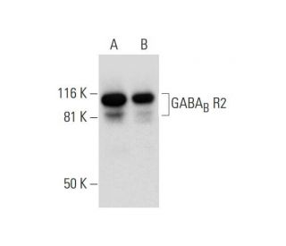 western blotting image from recommended GABAB R2 (H-10) monoclonal antibody replacement. Image 294456