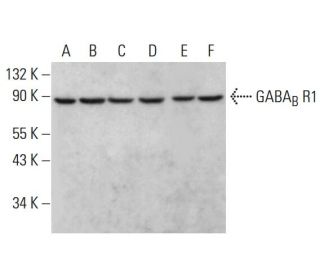 GABA<sub>B</sub> R1 Antibody (C-11) - Western Blotting - Image 381149The Double Nickase Plasmid features a U6 promoter for sgRNA expression, a 20 nt targeting sequence, and a gRNA scaffold to guide Cas9n. It includes a CBh promoter for Cas9n (D10A) and puromycin resistance, GFP for transfection verification, and nuclear localization signals (NLS). The 2A peptide allows co-expression of Cas9n and Puro from a single promoter, enabling precise genome editing with reduced off-target effects.