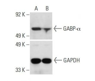 GABP-a siRNA (h): sc-37100. Western blot analysis of GABP-a expression in non-transfected control (A) and GABP-a siRNA tra 