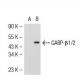 GABP-β1/2 Antibody (11) - Western Blotting - Image 54240