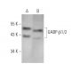 GABP-β1/2 Antibody (11) - Western Blotting - Image 373126 
