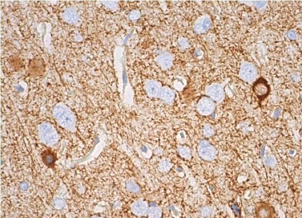 h.keigoooo　 サン　プラチナ GAD-65/67 Antibody (C-9) | SCBT - Santa Cruz Biotechnology