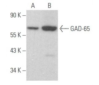 western blotting image from recommended GAD-65 (A-3) monoclonal antibody replacement. Image 354571