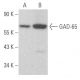 western blotting image from recommended GAD-65 (A-3) monoclonal antibody replacement. Image 354571